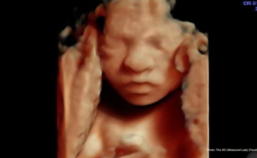 UK MP introduces amendment to allow abortion up to birth