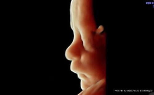 Pro-abortion group recommends using abortion pill for third-trimester abortions