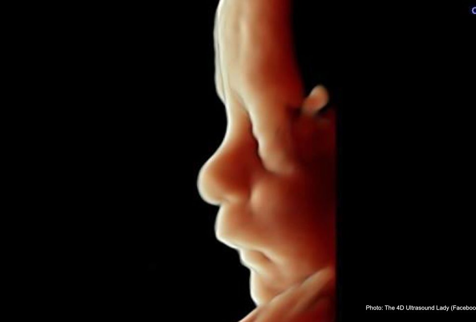 Pro-abortion group recommends using abortion pill for third-trimester abortions