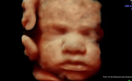 Third-trimester baby dies on floor after Singapore girl takes mail-order abortion drugs