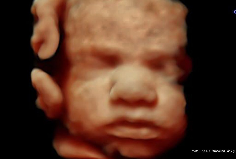 Third-trimester baby dies on floor after Singapore girl takes mail-order abortion drugs