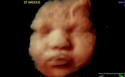 UK bill decriminalizing all self-abortions ‘desperately out of step with the public’