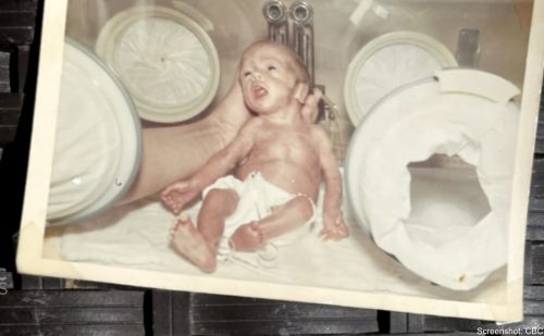 Doctor reunites with preemie he saved decades ago after anticipating a stillbirth
