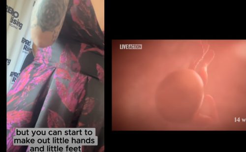 EXCLUSIVE: Undercover video shows Virginia abortionist saying it’s ‘easy’ to dismember babies