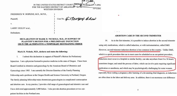 Image: Abortionist Mark Nichols Standard of Care testimony induction abortion in hospitals