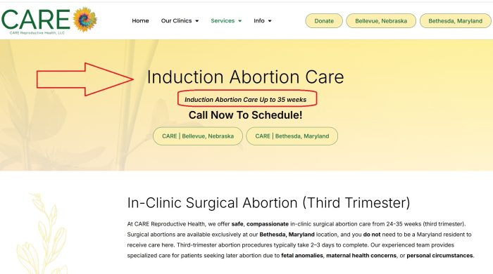 CARE late term induction abortion to 35 weeks