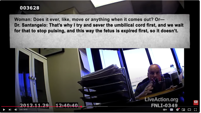 Late term abortionist described umbilical cord transection UCT in Live Action undercover video