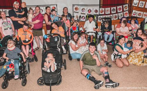 New AAP guidelines affirm Trisomy 13 and 18 are no longer ‘incompatible with life’