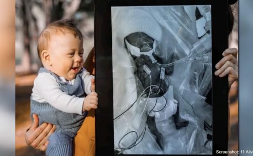 Preemie born at 22 weeks now a thriving toddler: ‘He’s a walking miracle’