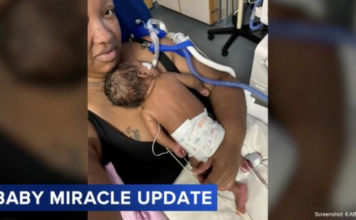 ‘Living testimony’: Her mother didn’t survive, but baby Miracle continues to fight