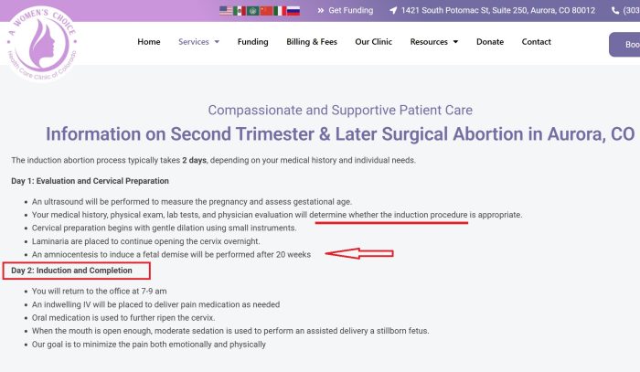 Women's Choice induction abortion later in pregnancy