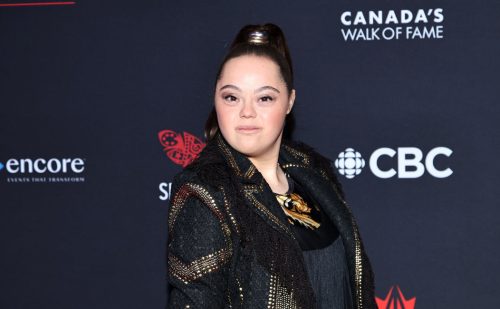 Model with Down syndrome stars in ‘coming-of-age romantic comedy’