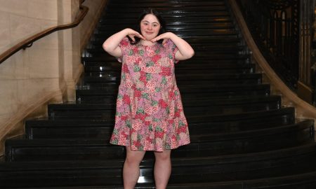 Ellie Goldstein, model with Down syndrome.