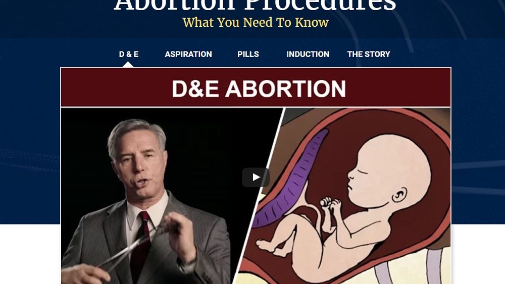Abortion Procedures Site