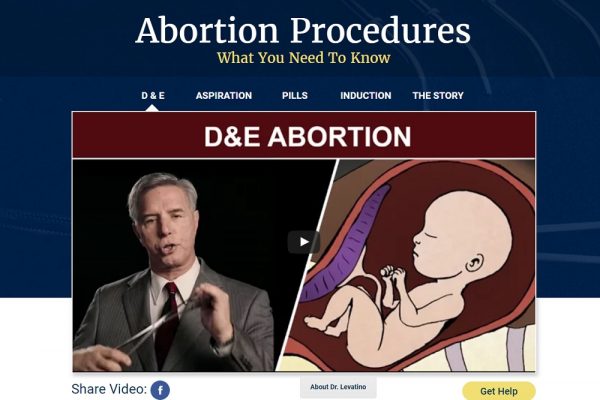 Abortion Procedures Site