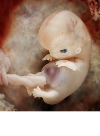 fetal-development-image-small fetal-development-image-small